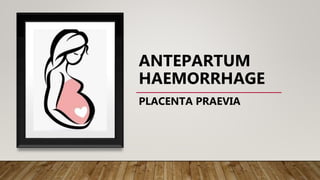 ANTEPARTUM
HAEMORRHAGE
PLACENTA PRAEVIA
 