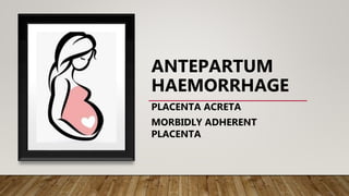 ANTEPARTUM
HAEMORRHAGE
PLACENTA ACRETA
MORBIDLY ADHERENT
PLACENTA
 