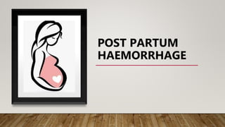 POST PARTUM
HAEMORRHAGE
 