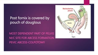 Obs gyne-2.pptx this contains vagina cervix, fallopian tube etc. | PPTX