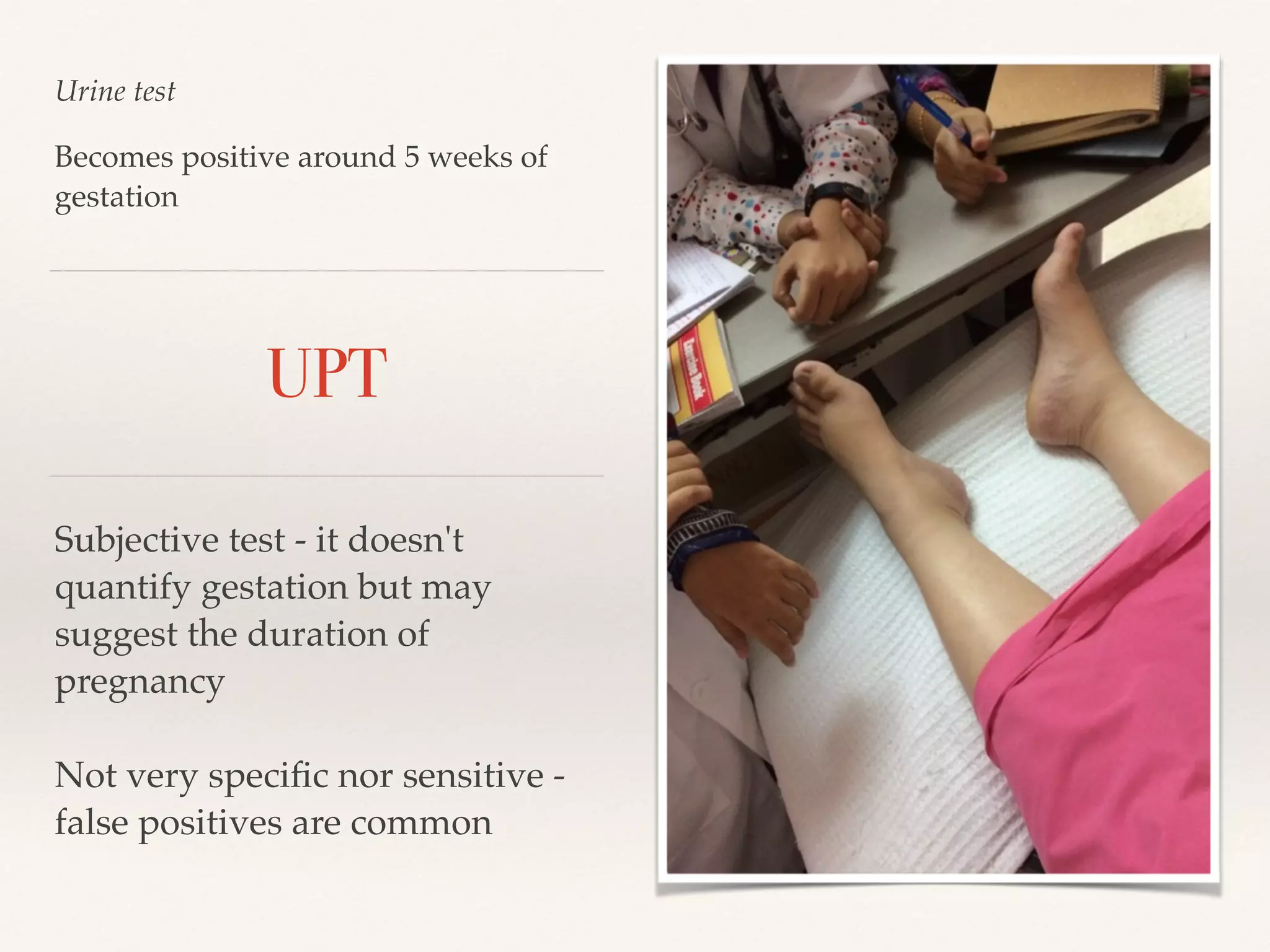 Urine test 
Becomes positive around 5 weeks of 
gestation 
UPT 
Subjective test - it doesn't 
quantify gestation but may 
suggest the duration of 
pregnancy! 
! 
Not very specific nor sensitive - 
false positives are common 
 