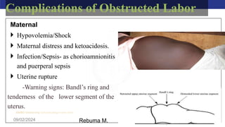 AMBO University School/college name here
09/02/2024 76
Complications of Obstructed Labor
Maternal
 Hypovolemia/Shock
 Maternal distress and ketoacidosis.
 Infection/Sepsis- as chorioamnionitis
and puerperal sepsis
 Uterine rupture
-Warning signs: Bandl’s ring and
tenderness of the lower segment of the
uterus.
Rebuma M.
 