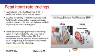 AMBO University School/college name here
Fetal heart rate tracings
• Auscultation of the fetal heart rate (FHR) is
performed by external or internal means.
• External monitoring is performed using a hand-
held Doppler ultrasound or external transducer,
which is placed on the maternal abdomen and held
in place by an elastic belt or girdle.
• Internal monitoring is performed by attaching a
screw-type electrode to the fetal scalp with a
connection to an FHR monitor. The fetal
membranes must be ruptured, and the cervix must
be at least partially dilated before the electrode
may be placed on the fetal scalp.
09/02/2024 Rebuma M. 81
 