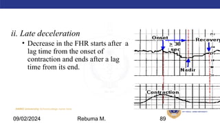 AMBO University School/college name here
ii. Late deceleration
• Decrease in the FHR starts after a
lag time from the onset of
contraction and ends after a lag
time from its end.
09/02/2024 Rebuma M. 89
 