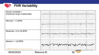 AMBO University School/college name here
FHR Variability
Absent variability =
Amplitude range undetectable
Minimal = < 5 BPM
Moderate = 6 to 25 BPM
Marked = > 25 BPM
09/02/2024 Rebuma M. 92
 