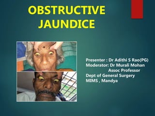 OBSTRUCTIVE
JAUNDICE
Presenter : Dr Adithi S Rao(PG)
Moderator: Dr Murali Mohan
Assoc Professor
Dept of General Surgery
MIMS , Mandya
 