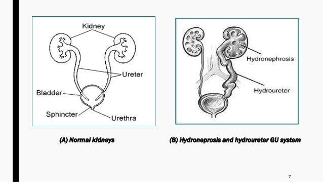 Minor Ailments During Pregnancy: Genitourinary system changes