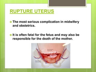 RUPTURE UTERUS
 The most serious complication in midwifery
and obstetrics.
 It is often fatal for the fetus and may also be
responsible for the death of the mother.
 
