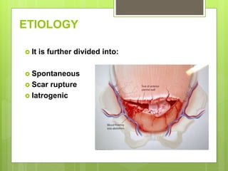 ETIOLOGY
 It is further divided into:
 Spontaneous
 Scar rupture
 Iatrogenic
 
