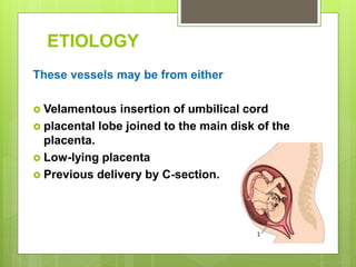 ETIOLOGY
These vessels may be from either
 Velamentous insertion of umbilical cord
 placental lobe joined to the main disk of the
placenta.
 Low-lying placenta
 Previous delivery by C-section.
 