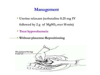 Management
• Uterine relaxant (terbutaline 0.25 mg IV
followed by 2 g of MgSO4 over 10 min)
• Treat hypovolaemeia
• Without placenta: Repositioning
 