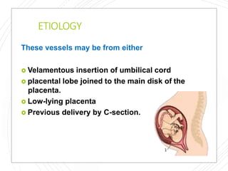 ETIOLOGY
These vessels may be from either
 Velamentous insertion of umbilical cord
 placental lobe joined to the main disk of the
placenta.
 Low-lying placenta
 Previous delivery by C-section.
 
