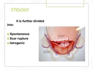 ETIOLOGY
It is further divided
into:
 Spontaneous
 Scar rupture
 Iatrogenic
 