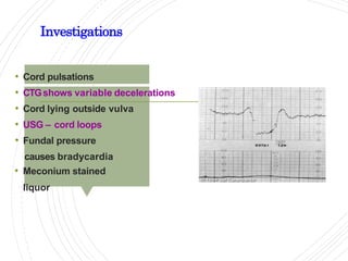 Investigations
• Cord pulsations
• CTGshows variable decelerations
• Cord lying outside vulva
• USG – cord loops
• Fundal pressure
causes bradycardia
• Meconium stained
liquor
 