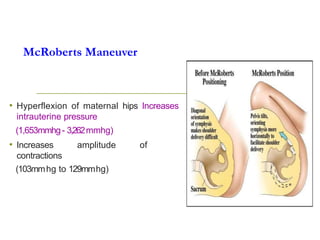 McRoberts Maneuver
• Hyperflexion of maternal hips Increases
intrauterine pressure
(1,653mmhg- 3,262mmhg)
• Increases amplitude of
contractions
(103mmhg to 129mmhg)
 