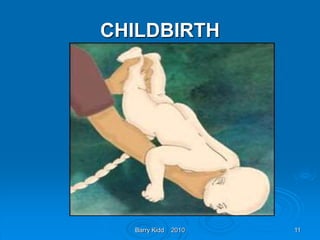 Barry Kidd 2010 11
CHILDBIRTH
 