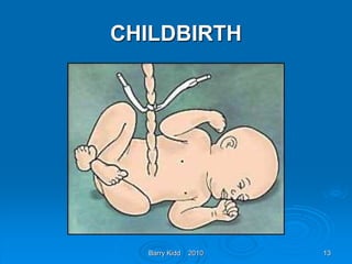 Barry Kidd 2010 13
CHILDBIRTH
 