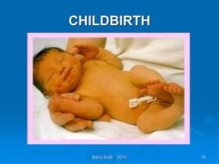 Barry Kidd 2010 18
CHILDBIRTH
 