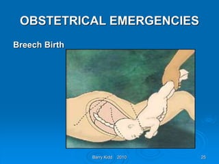 Barry Kidd 2010 25
OBSTETRICAL EMERGENCIES
Breech Birth
 