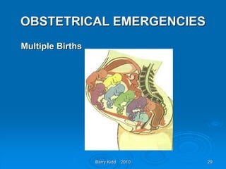 Barry Kidd 2010 29
OBSTETRICAL EMERGENCIES
Multiple Births
 