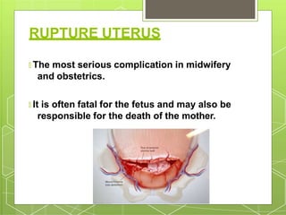 RUPTURE UTERUS
🞇 The most serious complication in midwifery
and obstetrics.
🞇 It is often fatal for the fetus and may also be
responsible for the death of the mother.
 