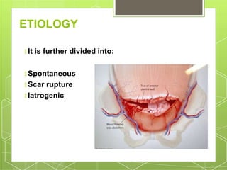 ETIOLOGY
🞇 It is further divided into:
🞇 Spontaneous
🞇 Scar rupture
🞇 Iatrogenic
 