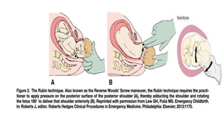 Obstetrical emergency & nsg management | PPTX