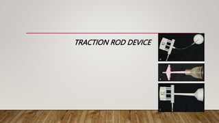 Tomstraction Rods OBSTETRICAL OPERATIONS & PROCEDURES.pptx