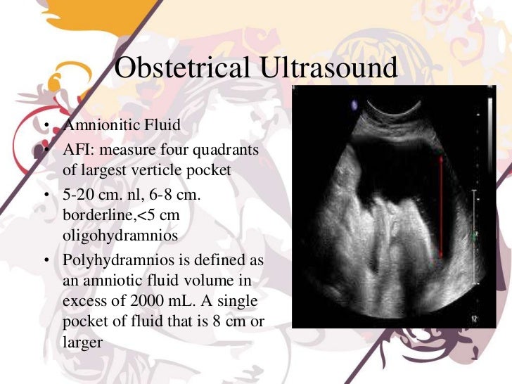 Obstetrical Ultrasound