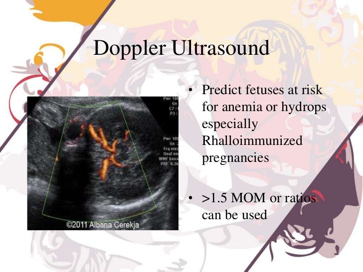 doppler ultrasound pregnancy doppler ultrasound pregnancy