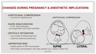 Obstetric Anesthesia ppt [ Natnael Dechasa ].pptx