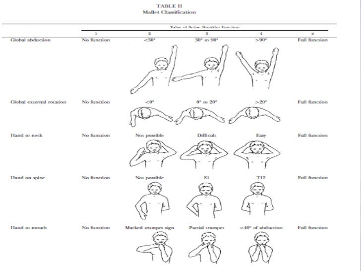 Recovery After Brachial Plexus Injury Mallet Classifi vrogue.co