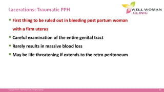 84Copyright © 2014 Well Woman Clinic. All rights reserved.
Lacerations: Traumatic PPH
 First thing to be ruled out in bleeding post partum woman
with a firm uterus
 Careful examination of the entire genital tract
 Rarely results in massive blood loss
 May be life threatening if extends to the retro peritoneum
 