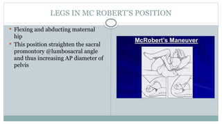 LEGS IN MC ROBERT’S POSITION
 Flexing and abducting maternal
hip
 This position straighten the sacral
promontory @lumbosacral angle
and thus increasing AP diameter of
pelvis
 