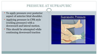 PRESSURE AT SUPRAPUBIC
 To apply pressure over posterior
aspect of anterior fetal shoulder.
 Applying pressure in CPR style
(rocking pressure) with a
downward and lateral motion.
 This should be attempted while
continuing downward traction
 