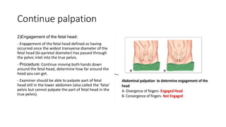 Continue palpation
2)Engagement of the fetal head:
- Engagement of the fetal head defined as having
occurred once the widest transverse diameter of the
fetal head (bi-parietal diameter) has passed through
the pelvic inlet into the true pelvis.
- Procedure: Continue moving both hands down
around the fetal head, determine how far around the
head you can get.
- Examiner should be able to palpate part of fetal
head still in the lower abdomen (also called the 'false'
pelvis but cannot palpate the part of fetal head in the
true pelvis).
 
