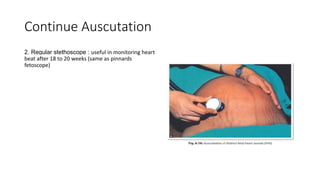 Continue Auscutation
2. Regular stethoscope : useful in monitoring heart
beat after 18 to 20 weeks (same as pinnards
fetoscope)
 