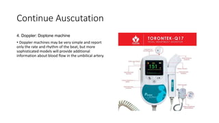 Continue Auscutation
4. Doppler: Doptone machine
• Doppler machines may be very simple and report
only the rate and rhythm of the beat, but more
sophisticated models will provide additional
information about blood flow in the umbilical artery.
 