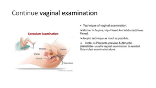 Continue vaginal examination
• Technique of vaginal examination:
Mother in Supine, Hips Flexed And Abducted,Knees
Flexed.
Aseptic technique as much as possible.
 Note: In Placenta previae & Abruptio
placentae- usually vaginal examination is avoided.
Only vulval examination done.
 