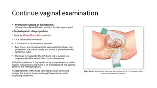 Continue vaginal examination
• Premature rupture of membranes:
- Check the collected fluid in posterior fornix (vaginal pool).
• Cephalopelvic disproportion:
- Done by Muller-MunroKerr method.
- It is a bimanual examination
• It is superficial to abdominal method
• Two fingers are introduced into vagina with the finger tips
placed over the ischial spines and thumb is placed over the
symphysis pubis.
• The head is grasped by the left hand and is pushed in a
downward and backward direction into the pelvis.
• No disproportion- if the head can be pushed down up to the
level of ischial spines and there is no overlapping of the parietal
bone on the symphysis pubis.
• Disproportion- if the head cannot be pushed down and
instead the parietal bone overhangs the symphysis pubis
displacing the thumb.
 