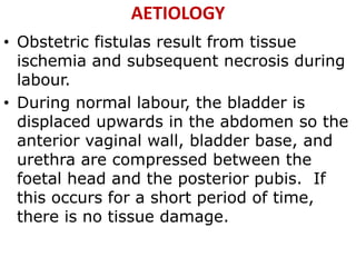 AETIOLOGY
• Obstetric fistulas result from tissue
ischemia and subsequent necrosis during
labour.
• During normal labour, the bladder is
displaced upwards in the abdomen so the
anterior vaginal wall, bladder base, and
urethra are compressed between the
foetal head and the posterior pubis. If
this occurs for a short period of time,
there is no tissue damage.
 