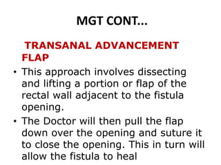 MGT CONT...
TRANSANAL ADVANCEMENT
FLAP
• This approach involves dissecting
and lifting a portion or flap of the
rectal wall adjacent to the fistula
opening.
• The Doctor will then pull the flap
down over the opening and suture it
to close the opening. This in turn will
allow the fistula to heal
 