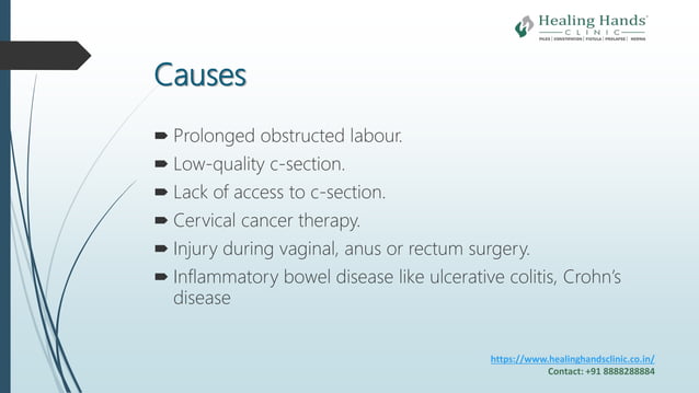 Obstetric Fistula Causes Symptoms And Treatment