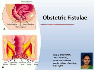 Obstetric Fistulae
Mrs. U SREEVIDYA,
Msc. NURSING,
Associate Professor,
Apollo college of nursing,
CHITTOOR
 