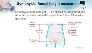 Symphysis–fundal height measurement
• Symphysis–fundal height (SFH) should be measured and
recorded at each antenatal appointment from 24 weeks’
gestation.
 
