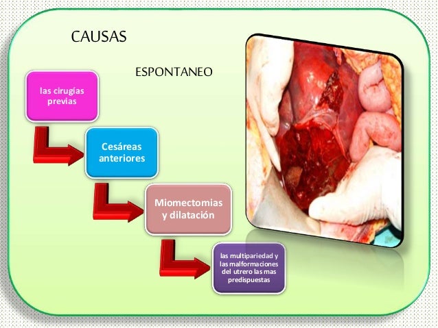 NACIMIENTO POR FORCEPS Y PARTO HUMANIZADO