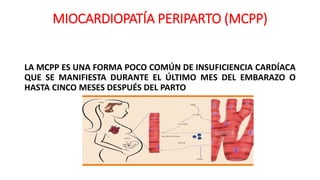 MIOCARDIOPATÍA PERIPARTO (MCPP)
LA MCPP ES UNA FORMA POCO COMÚN DE INSUFICIENCIA CARDÍACA
QUE SE MANIFIESTA DURANTE EL ÚLTIMO MES DEL EMBARAZO O
HASTA CINCO MESES DESPUÉS DEL PARTO
 