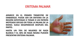 ERITEMA PALMAR
APARECE EN EL PRIMER TRIMESTRE DE
EMBARAZO. PUEDE SER UN ERITEMA EN LA
REGIÓN HIPOTENAR O TENAR O UN PATRÓN
MOTEADO DIFUSO EN TODA LA PALMA DE LA
MANO. SUELE DESAPARECER DESPUÉS DEL
PARTO.
HASTA UN 70% DE MUJERES DE RAZA
BLANCA Y EL 30% DE RAZA NEGRA PUEDEN
PRESENTAR ERITEMA PALMAR.
 
