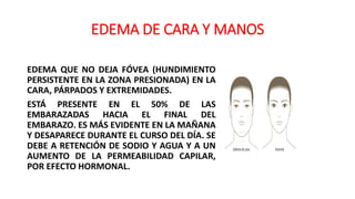 EDEMA DE CARA Y MANOS
EDEMA QUE NO DEJA FÓVEA (HUNDIMIENTO
PERSISTENTE EN LA ZONA PRESIONADA) EN LA
CARA, PÁRPADOS Y EXTREMIDADES.
ESTÁ PRESENTE EN EL 50% DE LAS
EMBARAZADAS HACIA EL FINAL DEL
EMBARAZO. ES MÁS EVIDENTE EN LA MAÑANA
Y DESAPARECE DURANTE EL CURSO DEL DÍA. SE
DEBE A RETENCIÓN DE SODIO Y AGUA Y A UN
AUMENTO DE LA PERMEABILIDAD CAPILAR,
POR EFECTO HORMONAL.
 