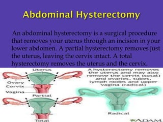 An abdominal hysterectomy is a surgical procedure
that removes your uterus through an incision in your
lower abdomen. A pa...